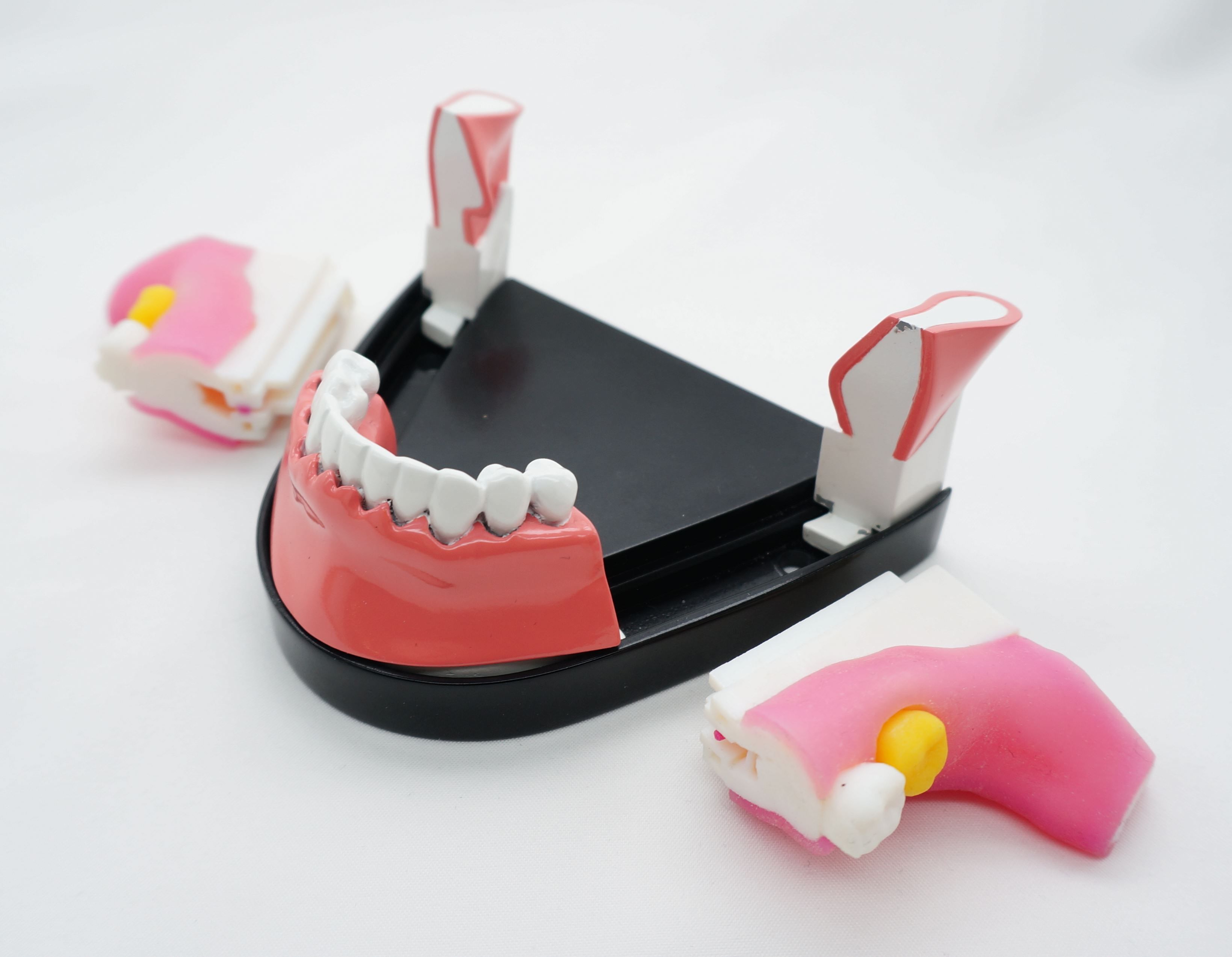 3rdmolar