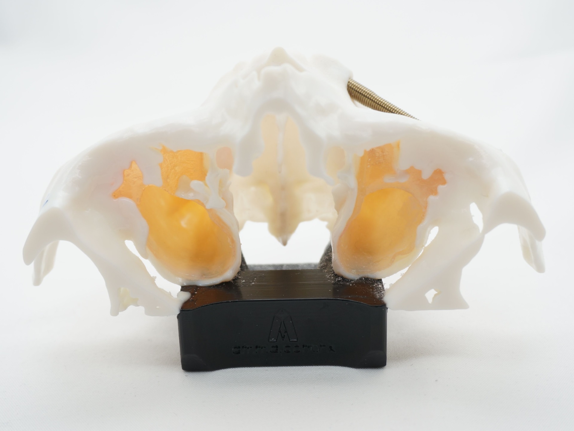 zygoma