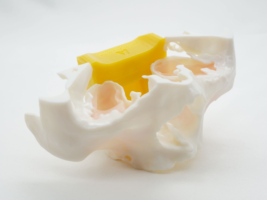 zygoma