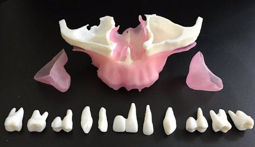 maxilla