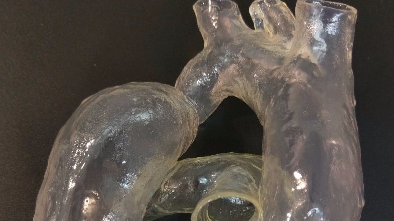 aorta