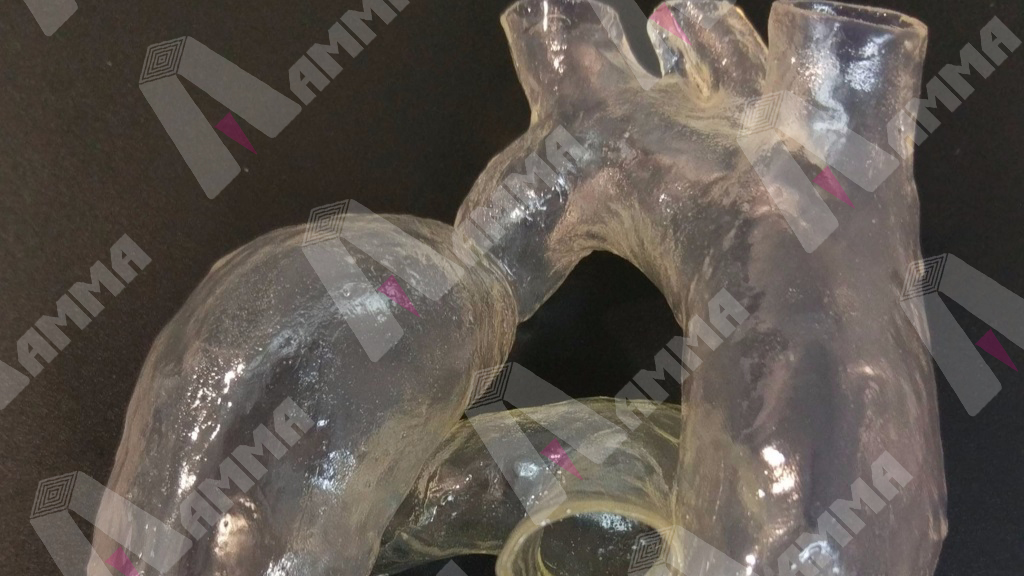 aorta
