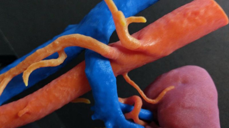 kidney