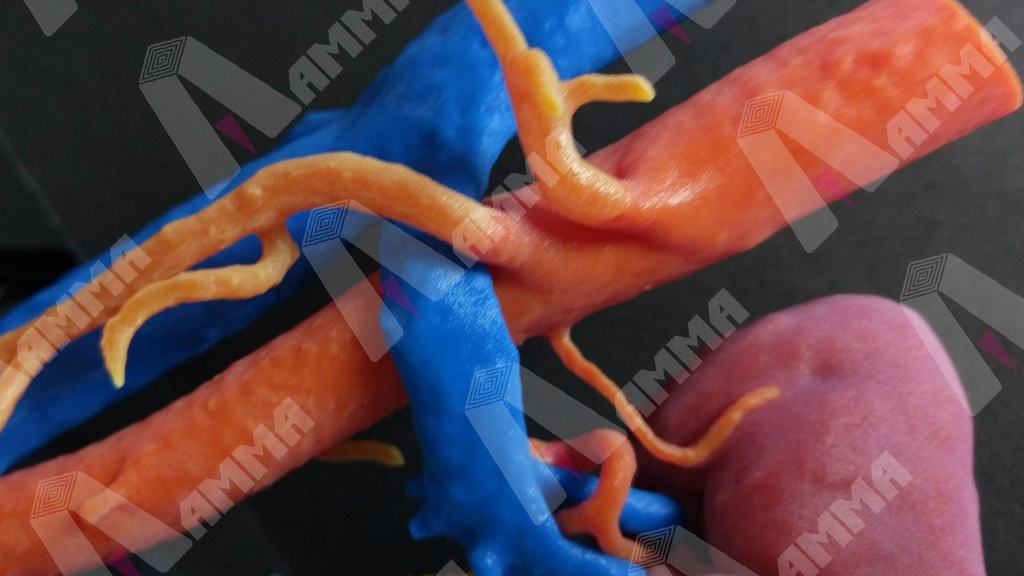 kidney