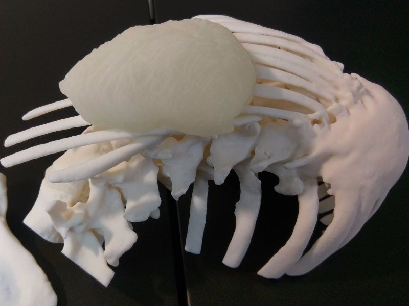 ribcage1