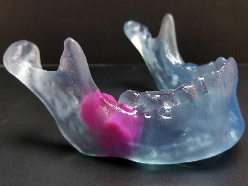 mandible1