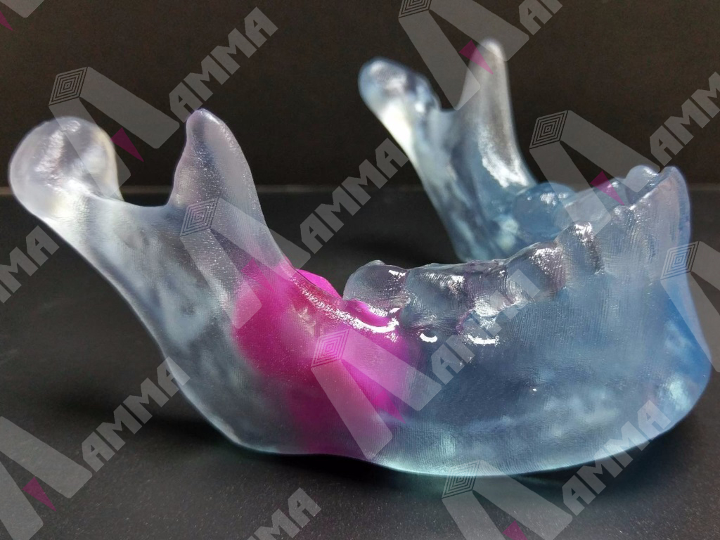 mandible1