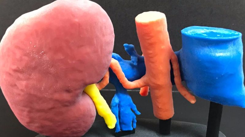 kidney