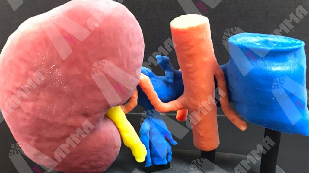 kidney