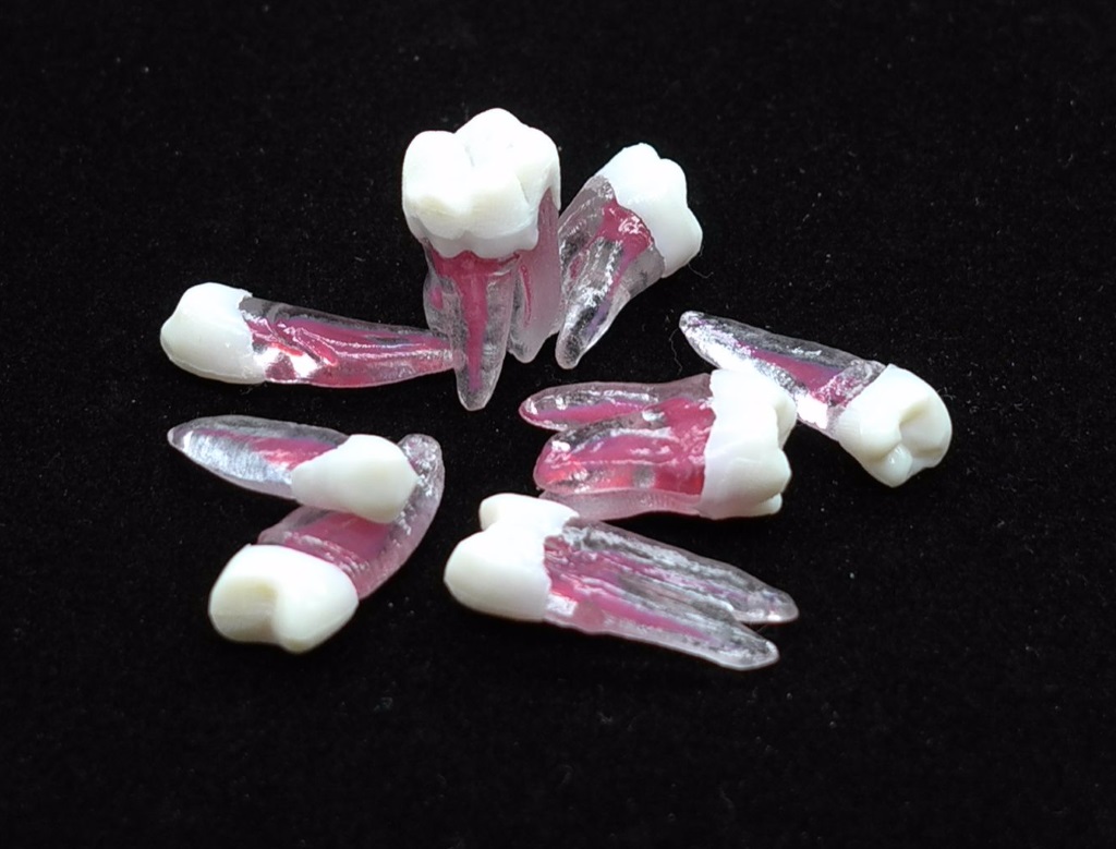 rootcanals